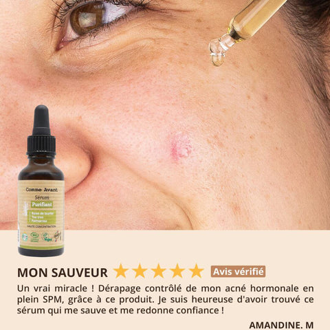 Notre sérum Purifiant : un héros 🦸