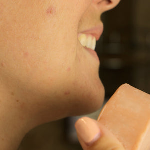 Comment ne plus avoir de boutons sur le visage ? - Comme Avant