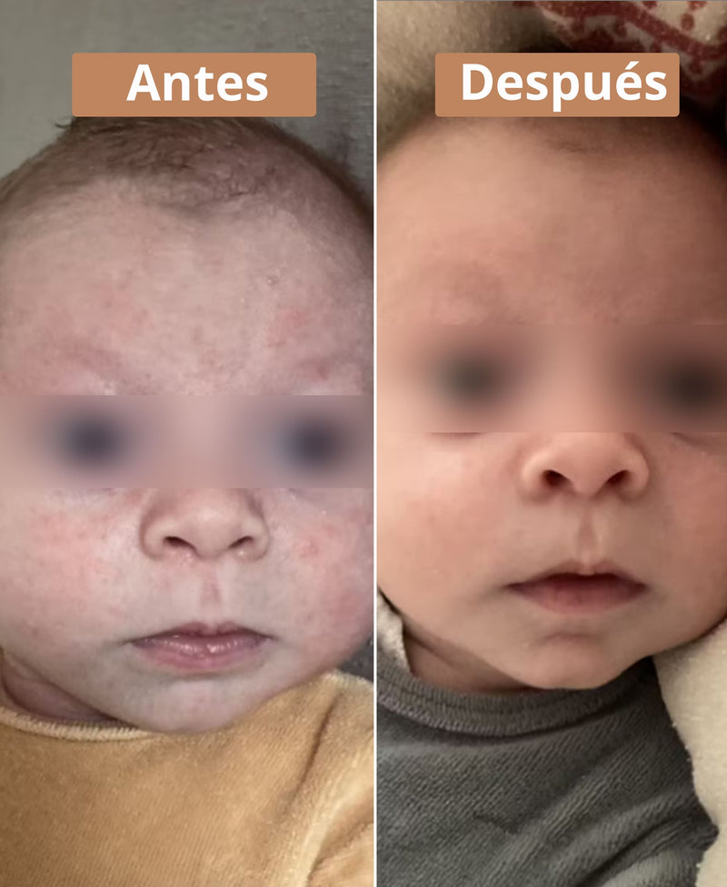 antes después jabón aceite oliva