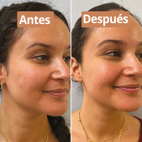 antes después hidratante