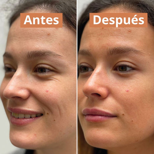 antes despues serum autobronceador comme avant