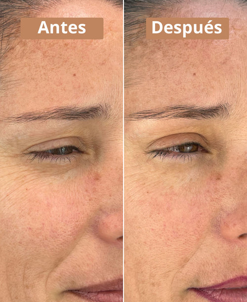 antes despues contorno de ojos comme avant